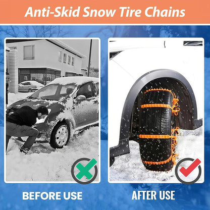 Universal Anti-Skid Snow Tire Chains, Emergency Traction Cables for Cars Suvs Trucks, Reusable Winter Safety Chains for Snow Ice Mud, 145-295Mm Tires (10)